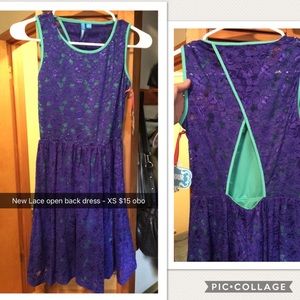 New Navy & Teal Lace Open Back Dress - short/mini